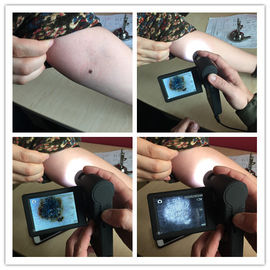 Piel video electrónica profesional Inspecter de Dermatoscope con micro tarjeta SD