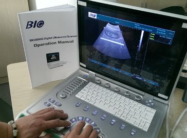 Analizador portátil en PC del ultrasonido de B/de W 15 peso de la pantalla del ordenador portátil de la pulgada solamente 5kgs conveniente llevar