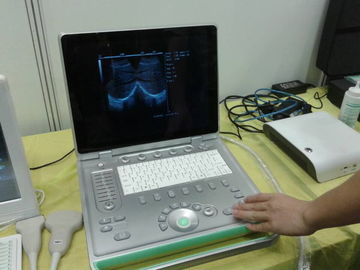 Fácil ligero de 3D Digitaces del ordenador portátil del escáner veterinario popular del ultrasonido llevar