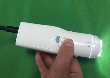 Colposcope electrónico de Digitaces de la cámara vaginal para encontrar la enfermedad de la cerviz Eealier