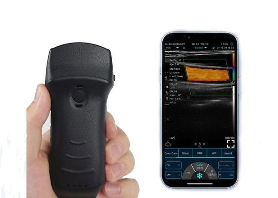 Escáner de vejiga de ultrasonido portátil Wifi de 305 mm convexo + lineal + sonda cardíaca