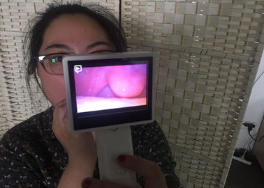 Otoscopio médico de Digitaces de la cámara de vídeo de Rhinoscopy de la endoscopia ENT para la nariz que comprueba con la pantalla LCD