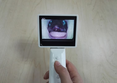 Oftalmoscopio de diagnóstico ENT del otoscopio del equipo del almacenamiento de tarjeta del SD automáticamente con el cable del USB