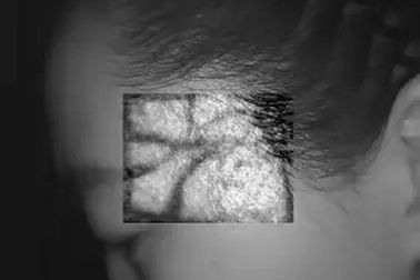 equipamiento médico infrarrojo de escritorio del hospital del buscador de la vena de la profundidad de la proyección de imagen de 10m m