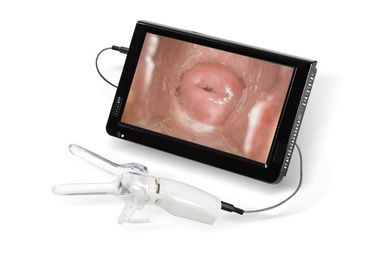 Mini Colposcope para la cámara vaginal cervical de Examintion conectada con la TV o la PC