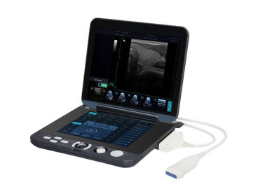 Escáner portátil del ultrasonido de 128 de las imágenes Digitaces del almacenamiento permanente con la pantalla de 12 pulgadas LED