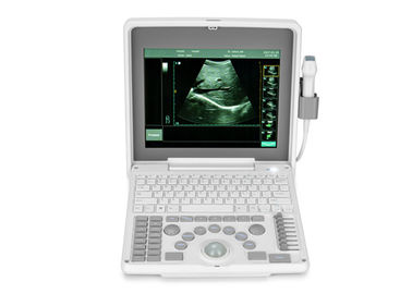Equipamiento médico móvil portátil BIO 3000J del escáner del ultrasonido del ordenador portátil de Digitaces con la pantalla de 1,12 pulgadas LED
