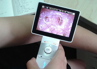Análisis Dermatoscope video de la piel y del pelo del PDA con 3,5 pulgadas LCD colorido