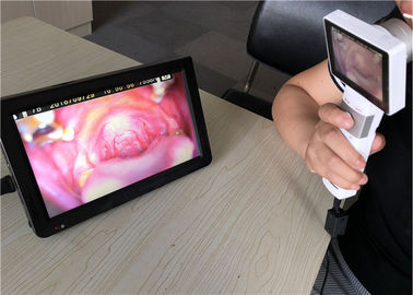 otoscopio video médico elegante de 1920 x 1080 pixeles Cmos USB para la piel del oído y la proyección de imagen general