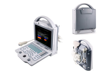 Sistema de diagnóstico del color del escáner del ultrasonido del ordenador portátil de la máquina de Doppler del color de Digitaces
