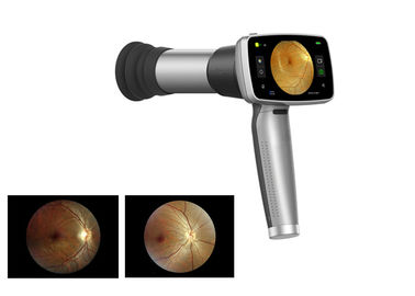 Cámara video del fondo del PDA del oftalmoscopio 45°