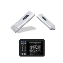 El escáner portátil del ultrasonido del PDA de la punta de prueba de Doppler del color de la palma con 220g carga solamente