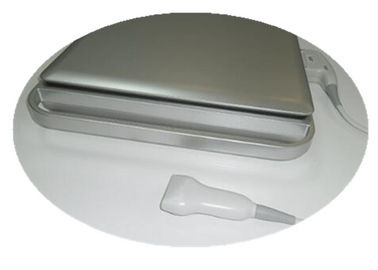 escáner del ultrasonido de Doppler del color 3d/Doppler de mano con la batería incorporada