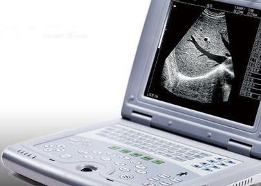 Máquina portátil del ultrasonido para el peso portátil 2.2kgs del escáner del ultrasonido del embarazo solamente
