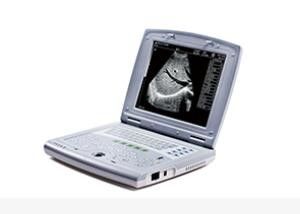 Escáner portátil del ultrasonido del bebé de la máquina portátil del ultrasonido para la pediatría