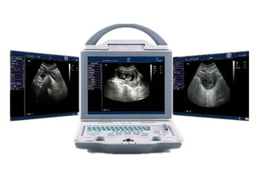Escáner portátil del ultrasonido de la máquina del ultrasonido del hospital con los conectores duales de la punta de prueba
