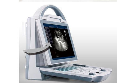 Escáner portátil del ultrasonido de la máquina casera del ultrasonido con solamente el peso 4.5kgs