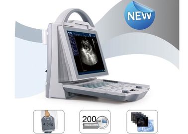 Escáner portátil del ultrasonido del escáner móvil del ultrasonido con la punta de prueba convexa linear transvaginal