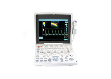 Coloree el escáner portátil del ultrasonido del sistema del ultrasonido de Doppler con el monitor de 12,1 pulgadas LED y 2 puertos de la punta de prueba