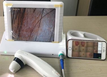 PDA Dermatoscope video de Digitaces con la exhibición de 8 de la pulgada imágenes de la pantalla 1,4,9