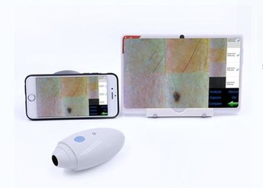La radio video del escáner del pelo de la piel de HD Digitaces Dermatoscope conectada con Mobilophone apoyó IOS Andriod