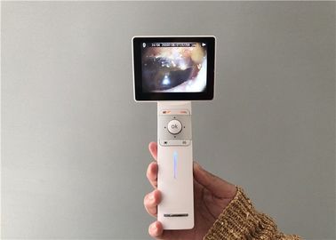 Proyección de imagen general y Dermatoscope del otoscopio video de Digitaces de la cámara del oído del micro tarjeta SD USB