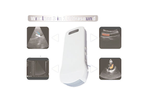 Cuerpo linear cardiaco 3 del PDA de Digitaces del ultrasonido del escáner de la conexión inalámbrica de Wifi EN 1 radio que carga 6 idiomas