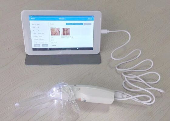 Colposcope video de Digitaces para el cuidado de la mujer cámara profesional del monitor médico de 10 o 7 pulgadas para la inspección de la cerviz