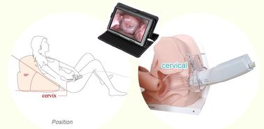 Colposcope electrónico endoscópico ginecológico de Digitaces del producto de la atención sanitaria para el uso en el hogar de las mujeres