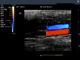 Escáner de diagnóstico portátil del ultrasonido del color de Digitaces del color de la máquina llena de Dopple