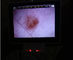 Oftalmoscopio video del otoscopio de Digitaces del monitor LCD para la inspección clínica del cuerpo humano