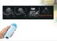 Escáner portátil de vejiga de mano, sonda microconvexa, ultrasonido, embarazo veterinario