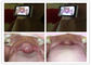 Inspección completa de Digitaces del otoscopio video de Digitaces con el otoscopio de la salida de tarjeta del SD USB