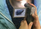 Cámara video electrónica de Dermatoscope del dispositivo de la inspección de la piel y del pelo con la exhibición de color TFT de 3 pulgadas