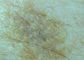 Lupa video inalámbrica portátil de la piel y del pelo del otoscopio de Digitaces del microscopio de la conexión de WIFI