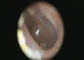 Otoscopio video neutral Dermatoscope de Digitaces de la luz blanca y cámara del otoscopio con la alta resolución