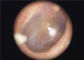 Endoscopio portátil médico disponible del otoscopio de la orejera disponible para la garganta del ojo del oído