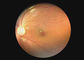 Endoscopio video de Dermatoscope Digital del otoscopio del equipo óptico de la cámara oftálmica de la garganta con 2 millones de pixeles