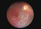 Endoscopio video de Dermatoscope Digital del otoscopio del equipo óptico de la cámara oftálmica de la garganta con 2 millones de pixeles