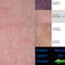 Analizador inalámbrico Digital de la piel del probador de la piel y del cuero cabelludo de Wifi con 8&quot; exhibición de Photoes de la pantalla 9
