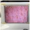 Sensor blanco de la humedad de la piel del inspector de la humedad de la piel de Wifi con la foto que exhibe en Ipad