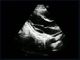 Escáner fetal del ultrasonido de Doppler del color de la lengua de Mutil con el micrófono - punta de prueba convexa