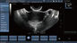 Escáner transvaginal del ultrasonido de Doppler del color de la punta de prueba, embarazo de Doppler del PDA