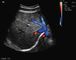 Escáner portátil del ultrasonido del embarazo con los transductores transvaginales convexos abdominales