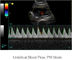 Escáner portátil ultrasónico del ultrasonido del dispositivo de diagnóstico de Ipad con almacenamiento de la imagen 500G