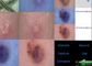 Detector Dermatoscope video de la piel y del cuero cabelludo con el informe de Analysisi del pigmento del aceite de la humedad flexible