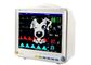 Equipo de supervisión paciente portátil del veterinario de los animales de la máquina del monitor paciente del animal doméstico del monitor paciente con los accesorios animales