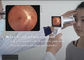 Telemedicina en ángulo de opinión de la cámara del fondo de Digitaces de la oftalmología del software opcional de Wifi de 45 grados para el informe