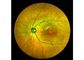 Equipo oftálmico de Angiograph Digital 160° de la retina