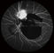 Cámara confocal del fondo de Opthalmoscope Digital de la retina con FOV 15°, 30°, talla 1024*1024 de la imagen 60°
